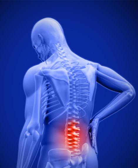 Post Operative Care for Spine Surgery