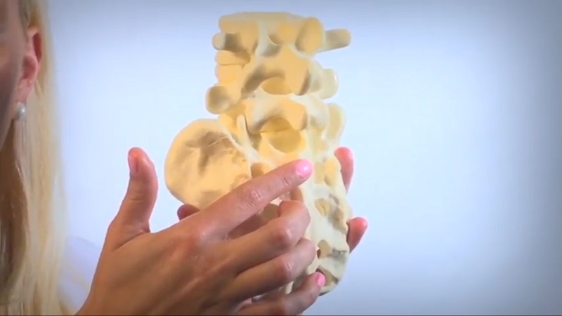 Spine- Interventional Pain Management