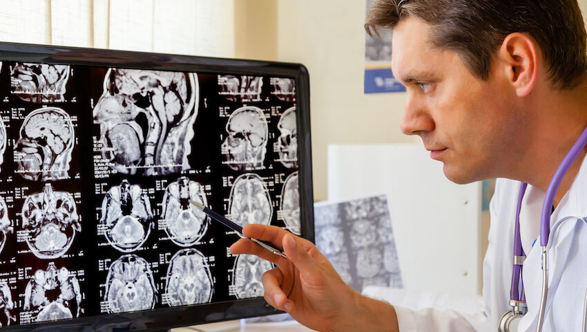 Doctor examing MRI reports